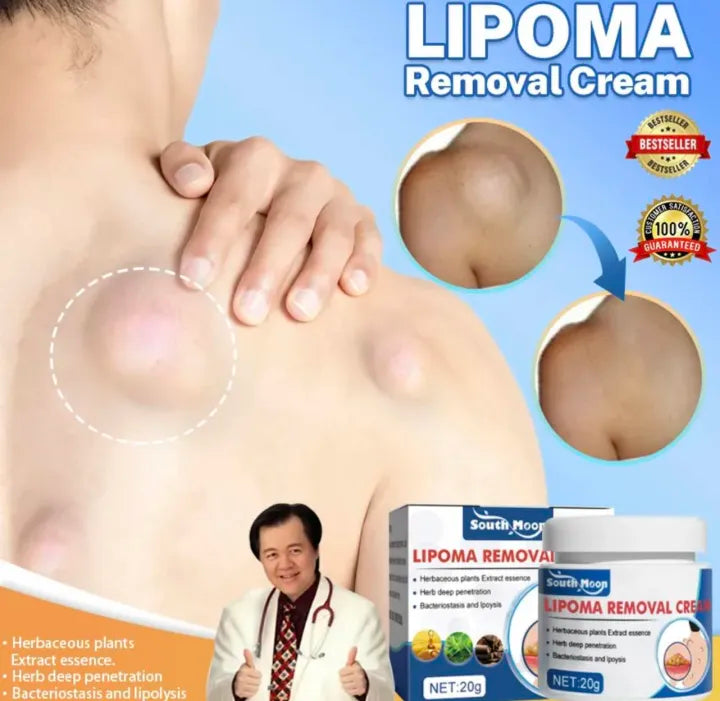 Lepoma Removal Cream (Instant Results, Guarenteed)